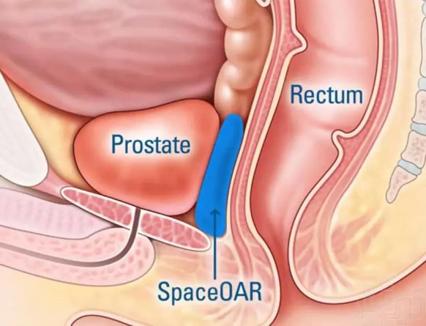 ‘Break-through’ prostate cancer screening could cut deaths by 40 percent