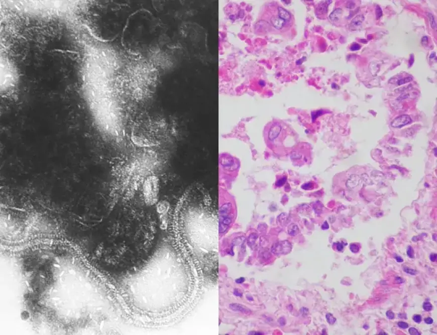 ނޭވާލާ ނިޒާމަށް ޖެހޭ ނުރައްކާތެރި ބައްޔެއް ފެތުރެނީ